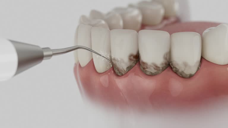 Reliable Dental contractor in Whitney, TX by Smile Center Dentistry